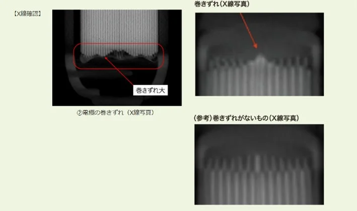 電極の巻きずれX線写真
